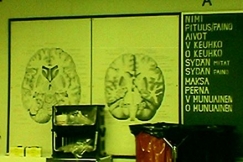 Kuva: Kuva patologian laitokselta. YLE kuvanauha. 